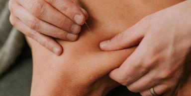 dryneedling meulebeke